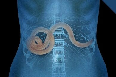 Parásitos no corpo humano
